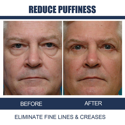 Men's Retinol Firming And Lightening Dark Circles Moisturizing Eye Cream b8c3e694 bf4f 4e2c ab09 bf78c315f910