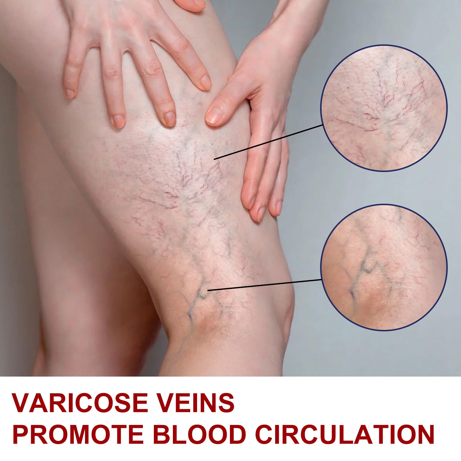 Earthworm Leg Vein Massage Cream For Relieving Leg Vascular Protrusion And Leg Swelling b908c826 7bdf 4c27 aa26 dc729d89261f