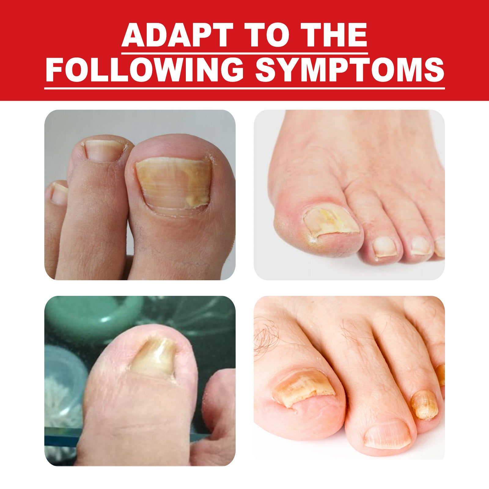 Endogenic Toenail Repair Nail Removal Essential Oil bd07a03f bc8d 4362 b9c9 a0570579fd78