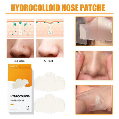 Nose Stick Clean Pore Gentle Care Peel bd6b3e4b 2b42 4380 8278 d2fe154844c5