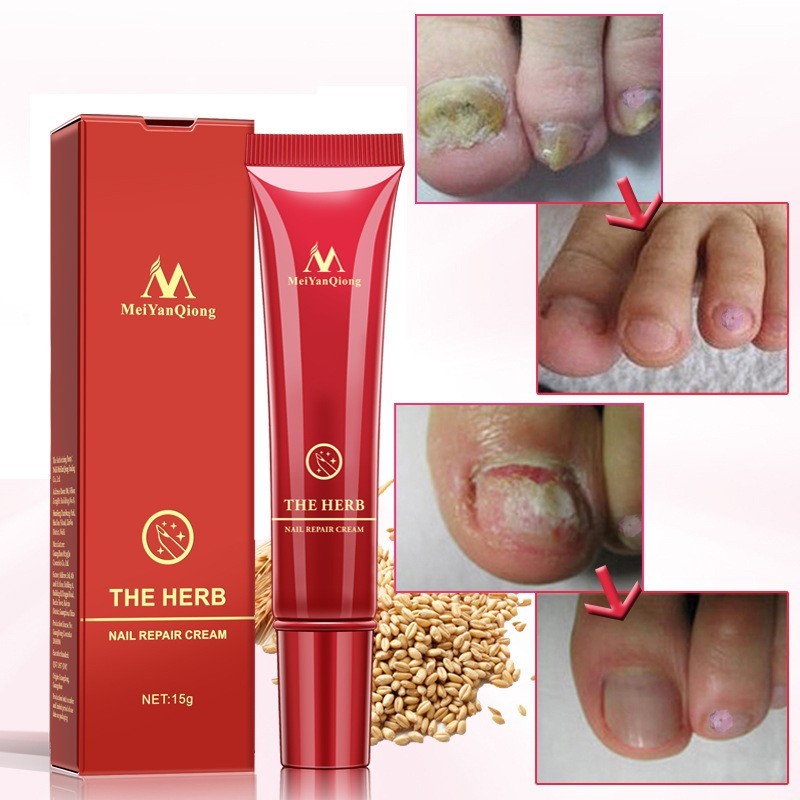 Beauty Hand And Foot Nail Repair Cream c003d355 9558 4f17 9bea 402cebff6eda