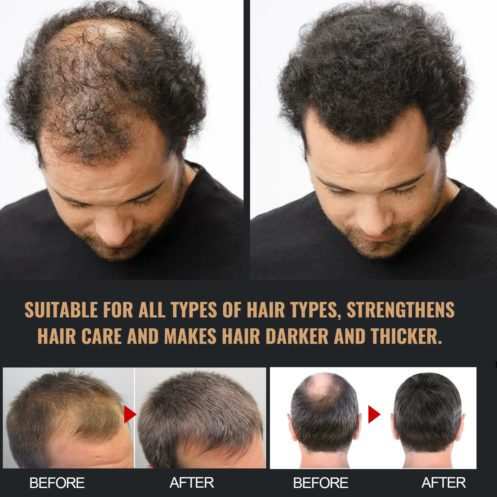 Anti-hair Loss Solid Thick Fluffy Hair Soft Strong Repair Shampoo c324d721 da41 4a8e 9f3b dde6904795d7