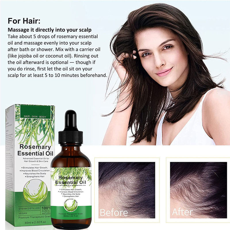 Rosemary Hair Growth c8e1a9d8 a2bb 44a1 8075 a3b4362ecee0