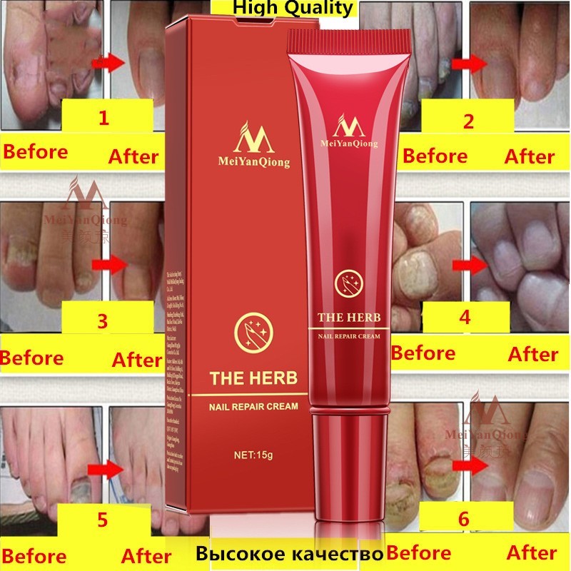 Beauty Hand And Foot Nail Repair Cream cab34bf3 94cd 4a94 b05e f6747011c850