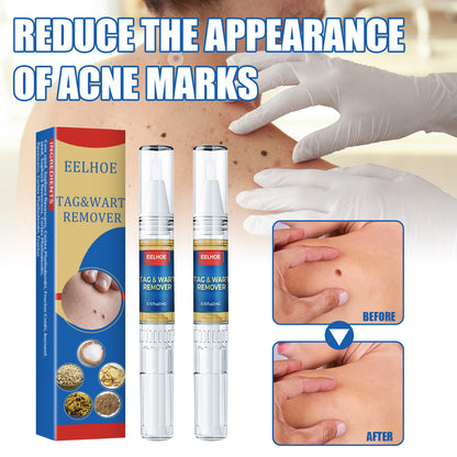 Skin Remove Nevus Pen To Liquid Body Skin Tags ce4583d6 392d 42f5 a268 a3a5f2cc57ec