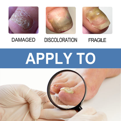 Nail Fungus Care Gel Repair ce92087e dd65 4093 ab65 54ffd1d23101