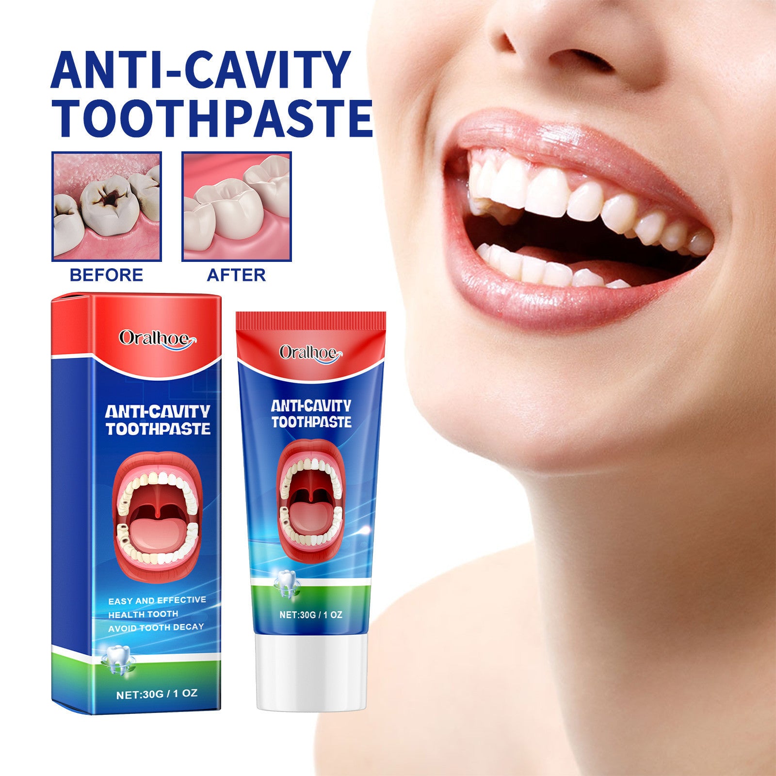 Anticavity Toothpaste Oral Cleaning Yellow Tooth Decay Tooth Care Gum Fixation Tooth Care Breath cebebbd0 f013 4361 ace3 04fa