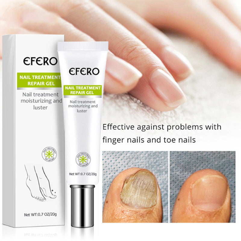Nail Treatment Serum Nail Foot Nail Fungus Removal Gel Anti Infection Onychomycosis Nail Repair Cream Feet Care d6f218fe 01ff