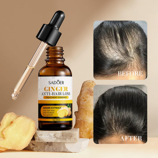 Ginger Care Oil Hair Loss Growth d71a7ee7 ab04 4ba6 afe1 61e0d65dcd60