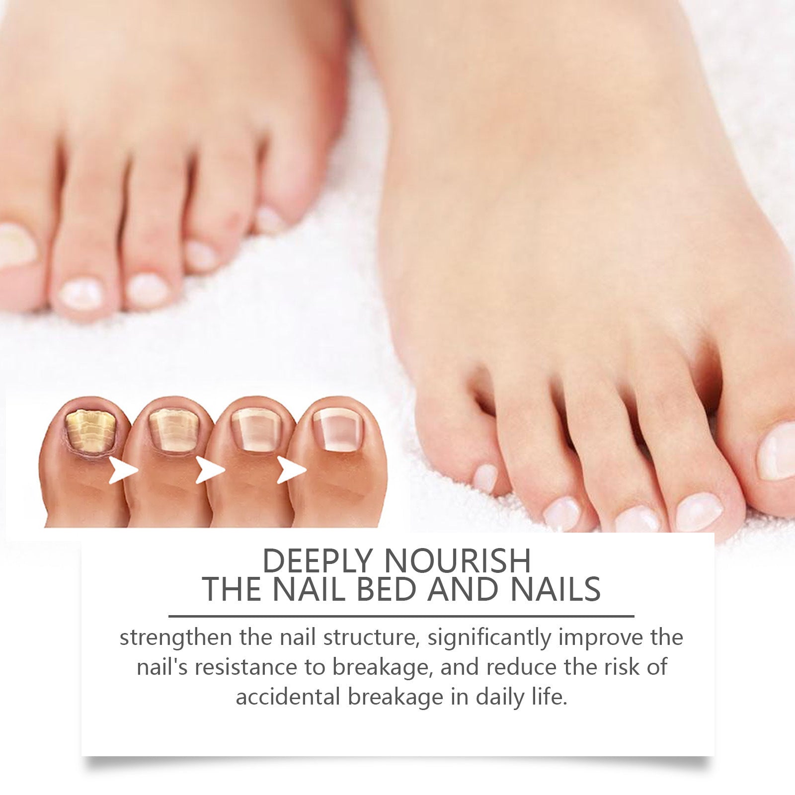 Bee Nail Repair Solution Brightening Nails dd9049f8 1673 42c6 8ff5 9d530da18d16