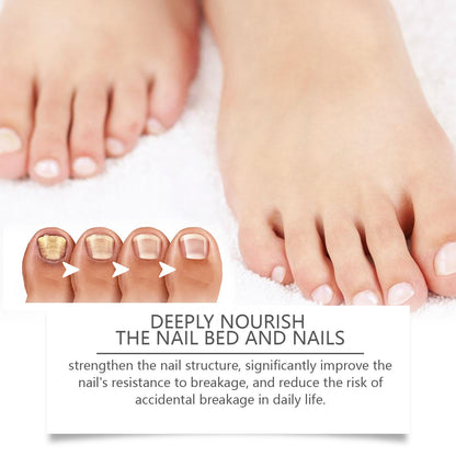 Bee Nail Repair Solution Brightening Nails dd9049f8 1673 42c6 8ff5 9d530da18d16