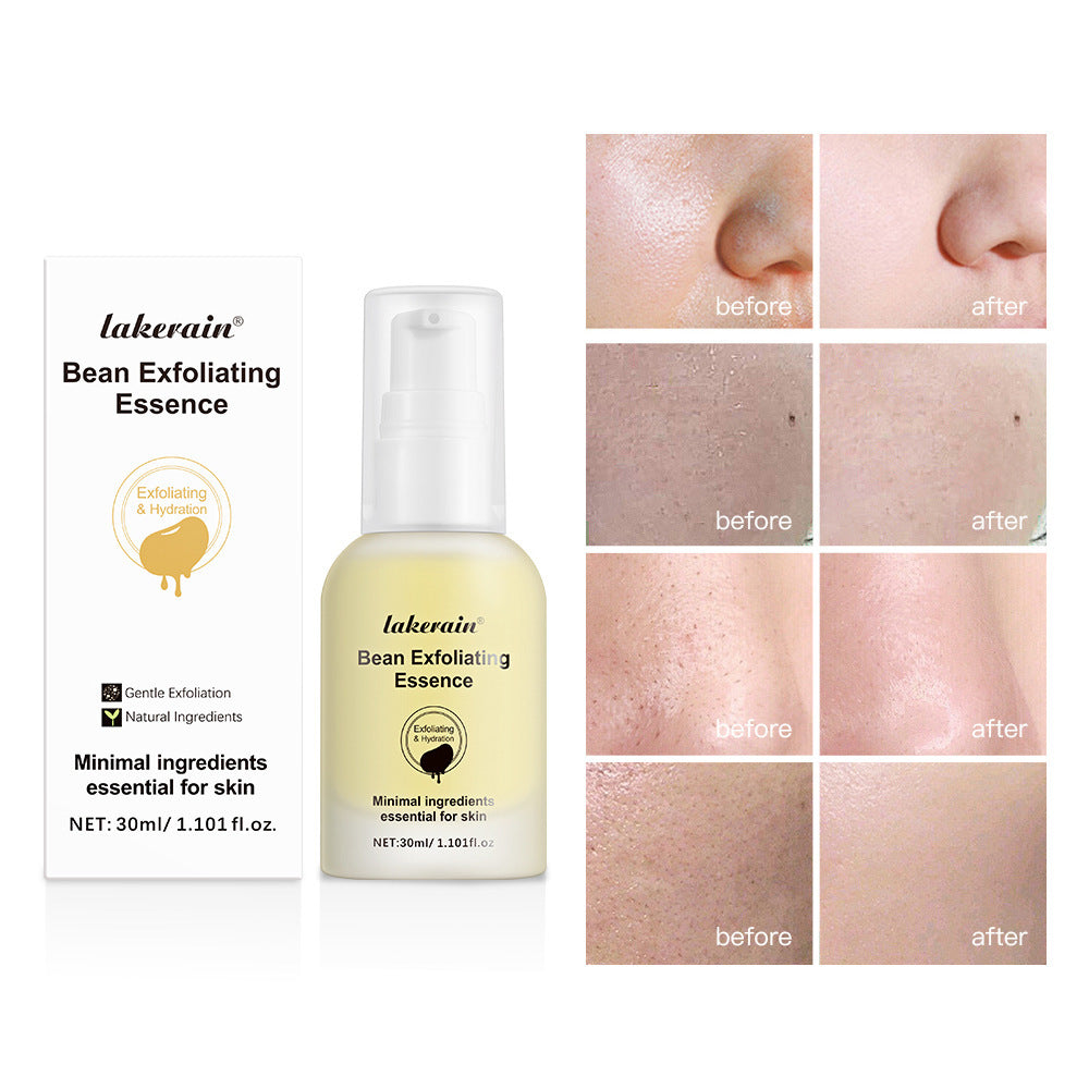 Soy Exfoliating Deep Cleansing Mild Treatment Oil e485d9d9 ace4 4341 9d7c e32f5309b2b5