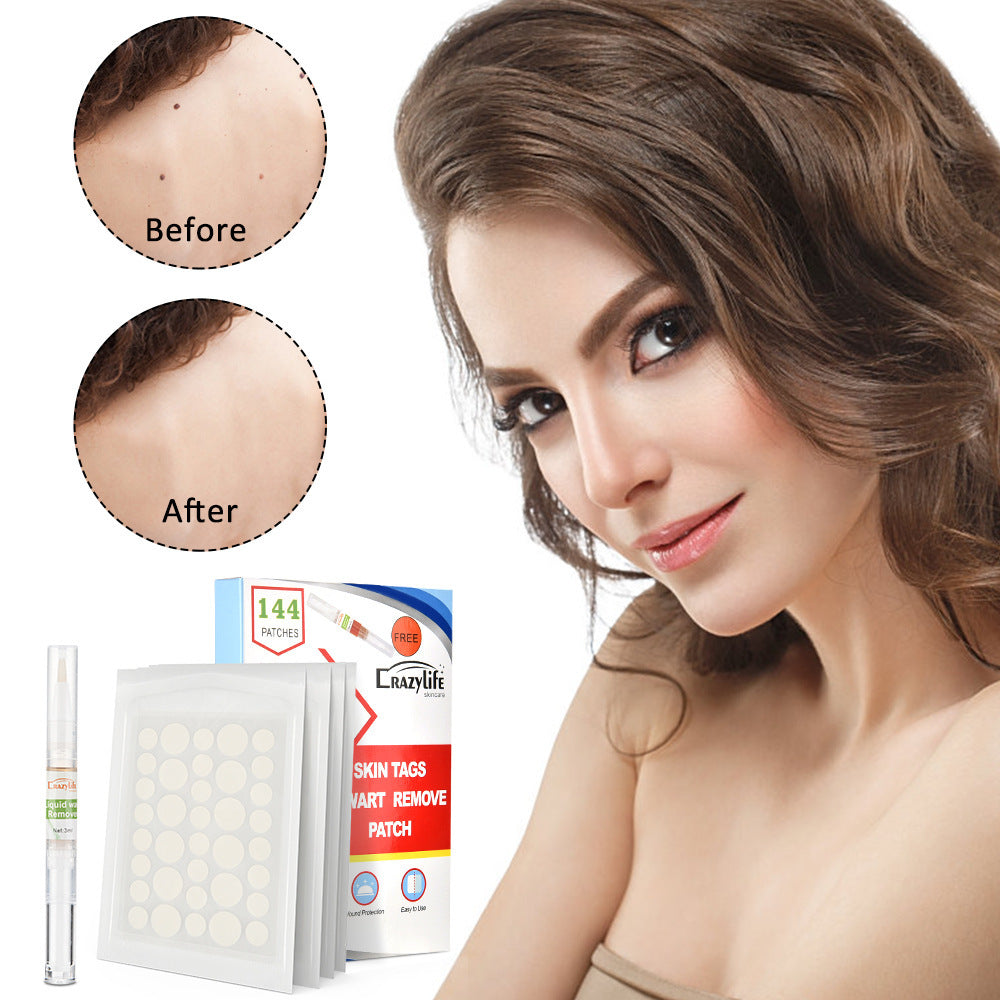 Callus Paste To Remove Warts And Plantar Warts, Foot Calluses And Feet e4cedf79 21a7 4383 a0bd 634f20d5e6fd