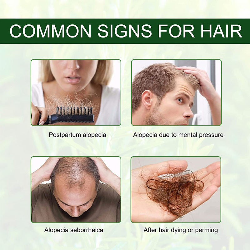 Rosemary Hair Growth e596e4d9 a10a 4e40 b2c4 5e098a55d881