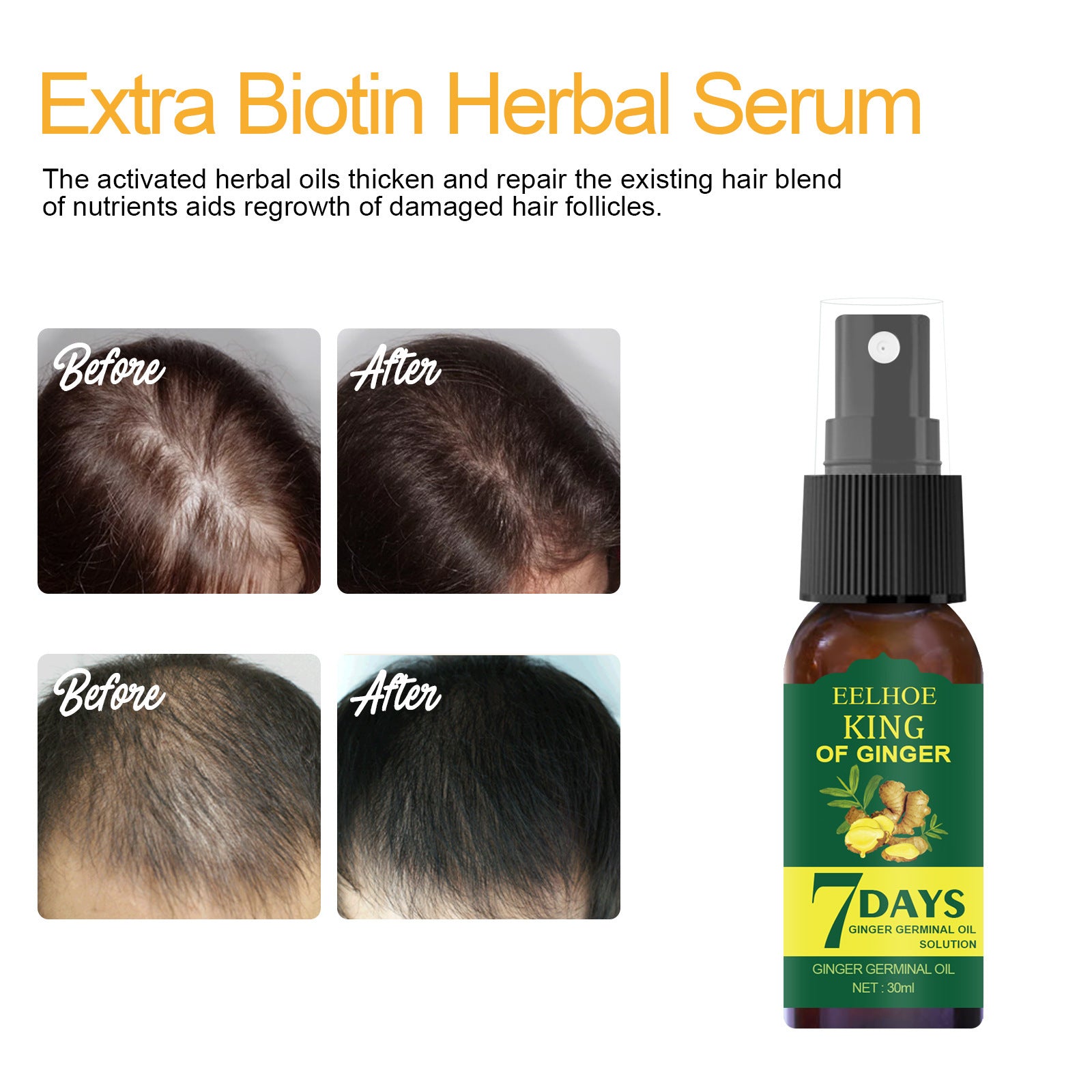 EELHOE Foreign Trade Cross-border Ginger Nutrition Spray Ginger Hair Root Spray Moisturizing Hair Hair Care Spray Spray e68f7