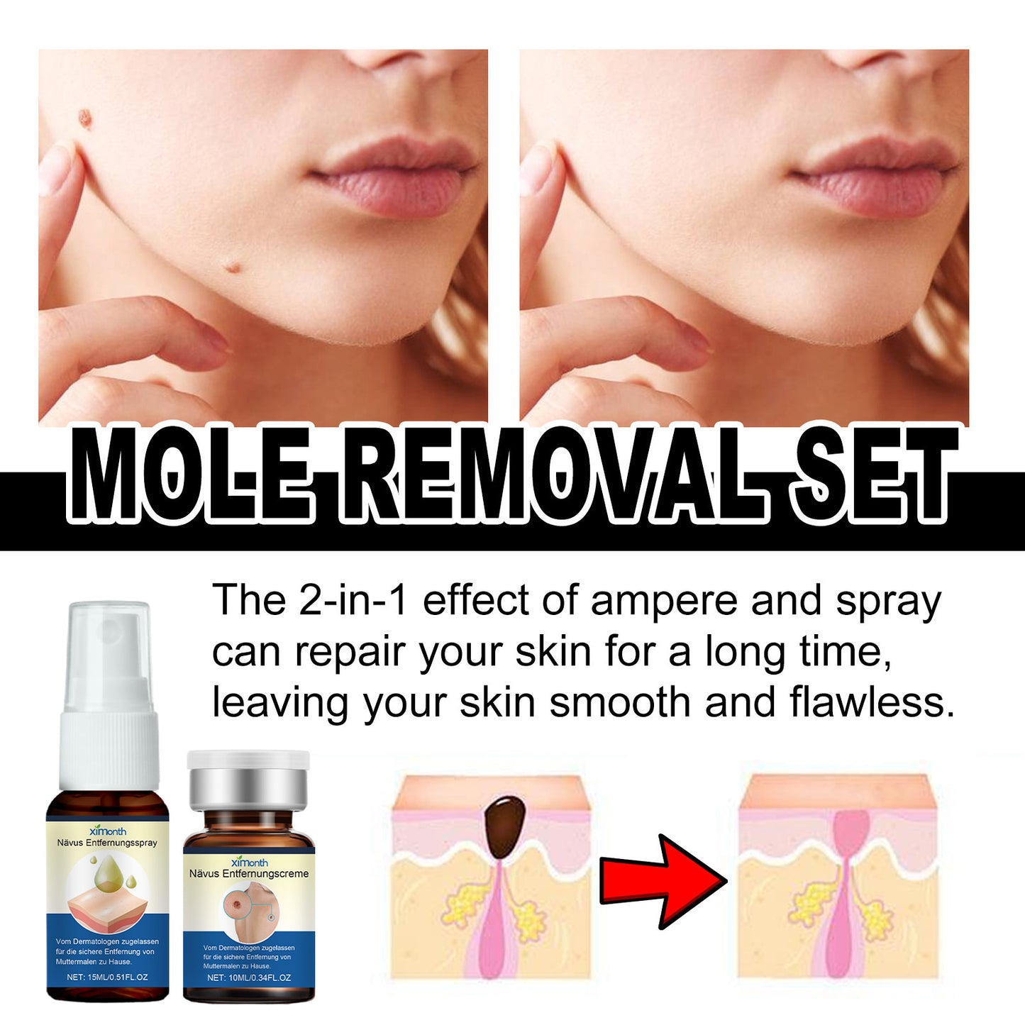 Skin Mole Care Suit Body Cleaning f5015b9e 02c8 4aee abcc 07b23ae4508c