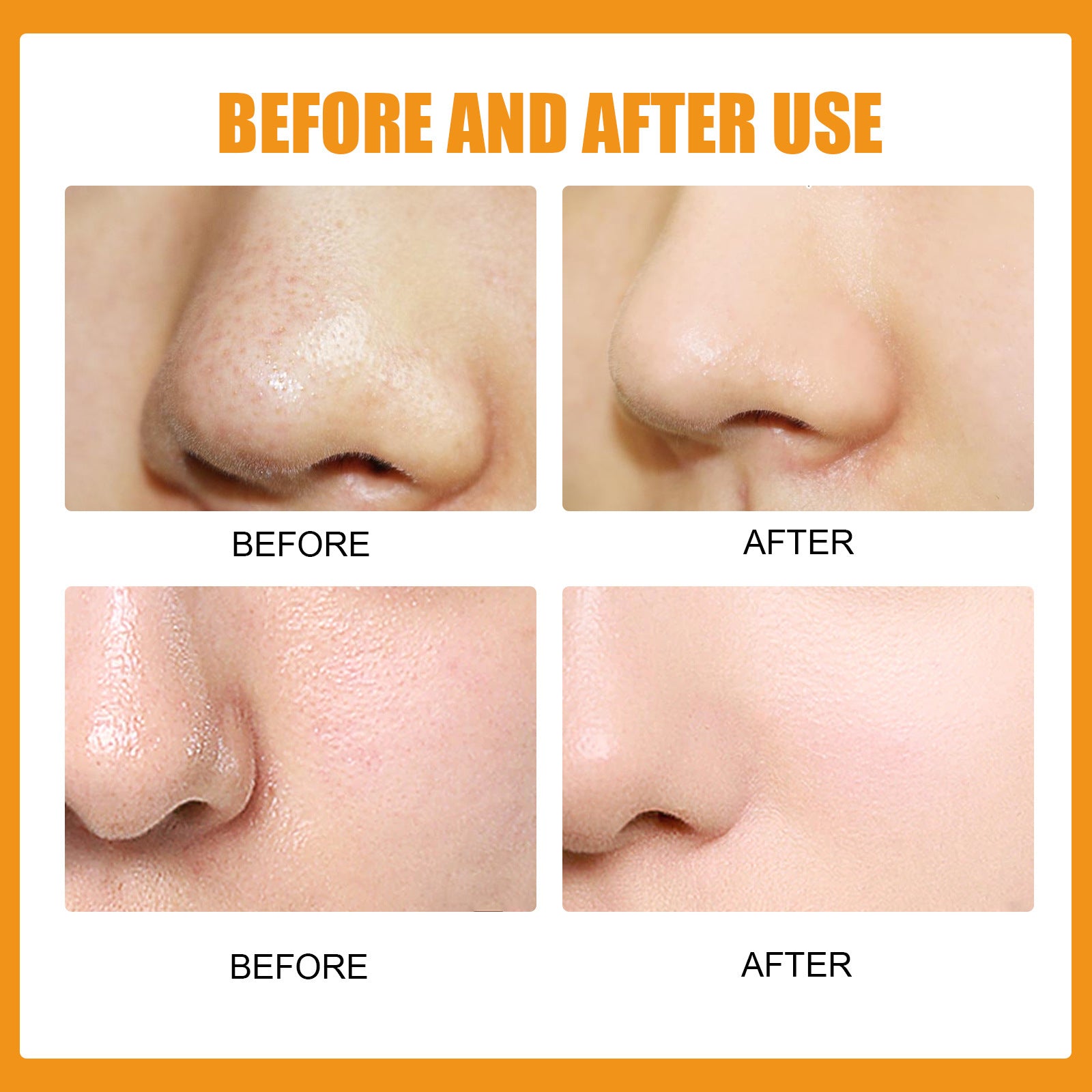 Nose Stick Clean Pore Gentle Care Peel f79e3d9c 7b1d 4a05 8c7b e4545b33adf4