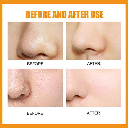 Nose Stick Clean Pore Gentle Care Peel f79e3d9c 7b1d 4a05 8c7b e4545b33adf4