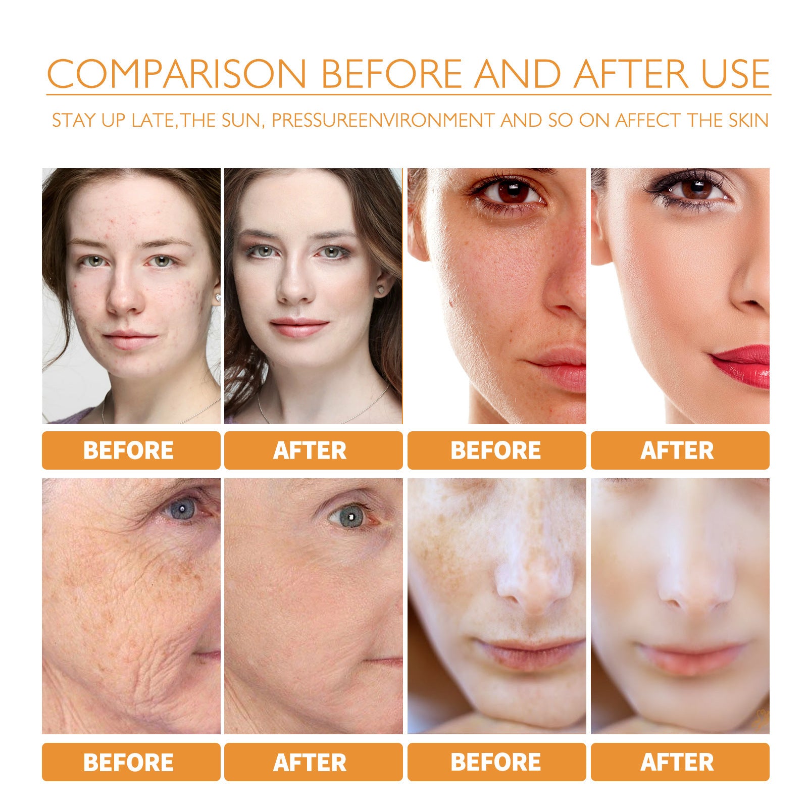 Turmeric Facial Smallpox Diluting Refreshing Oil Control f84c3593 090c 4712 a578 97848442de49