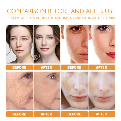 Turmeric Facial Smallpox Diluting Refreshing Oil Control f84c3593 090c 4712 a578 97848442de49