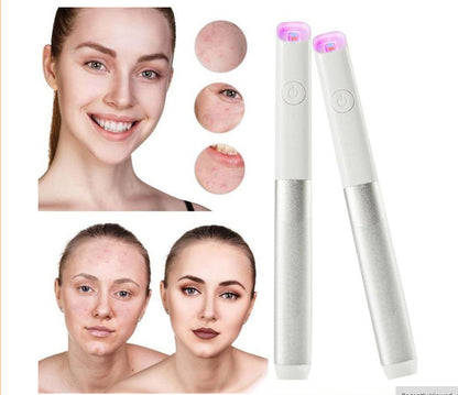 Household Safety Red Blue Light Smallpox Diluting Acne Beauty Instrument f944aed0 3030 4985 8a59 2ae24f86ab85