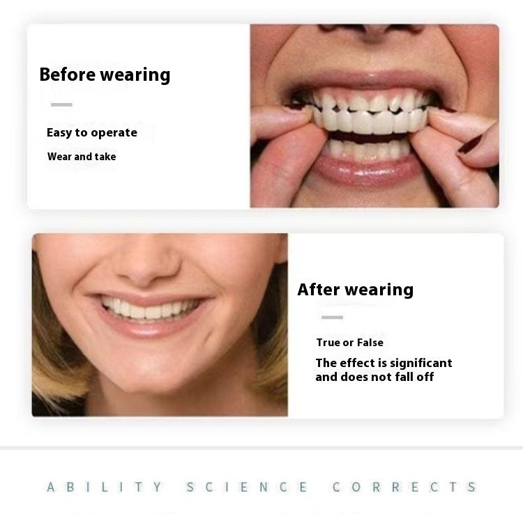 Simulation Teeth Tooth Socket Eating Artifact fbfdd904 85fb 446f 87d2 a0564af295fc
