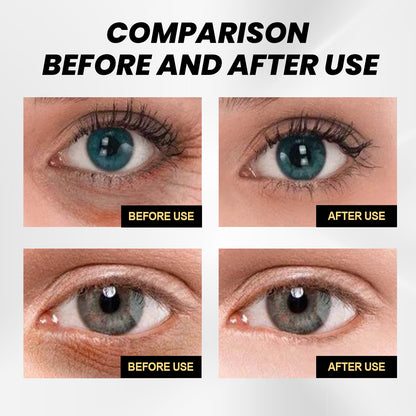 Fade Wrinkles Moisture Replenishment Firming Eye Skin Eye Cream ff059caa 24fe 43f4 9b4f 17be5e7895ca