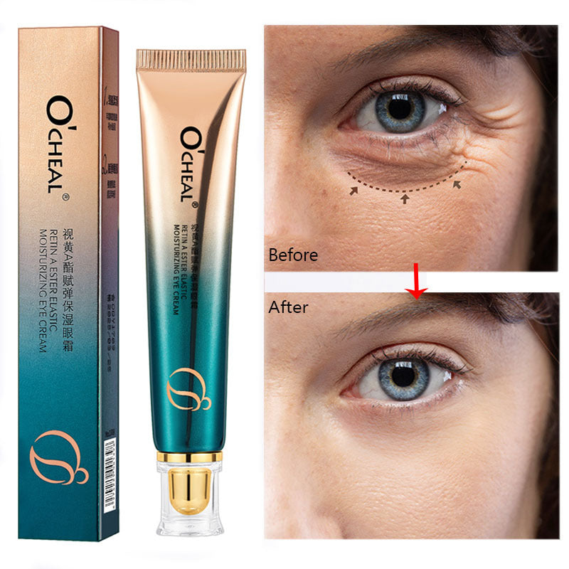 Moisturizing And Firming Eye Cream To Weaken Fine Lines And Dark Circles ffd2df96 89ca 490f b469 b00b84006038
